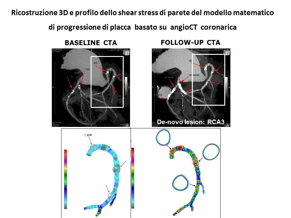 Ricostruzione 3D e profilo dello shear stress di